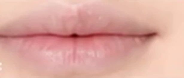 Kết quả môi Nano 3D Lips — trước khi thực hiện